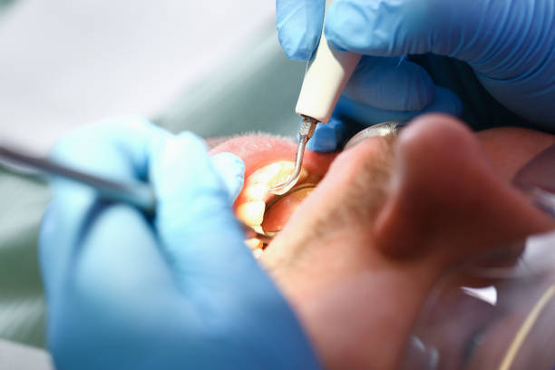 Best Emergency Dental Care for Broken or Chipped Teeth in Pagould, AR